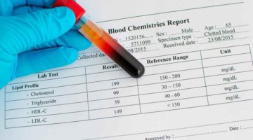 اختصارات تحليل الدم ومعانيها وكيفية قراءتها
