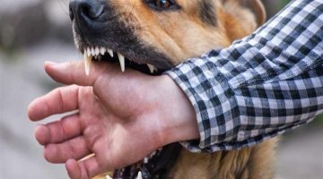 متى تظهر اعراض عضة الكلاب وطريقة التعامل الصحيح معها