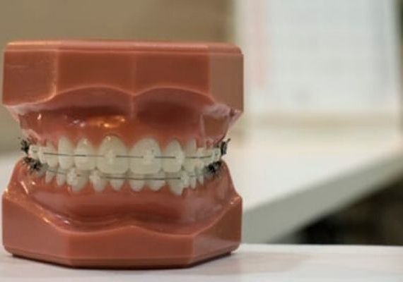 عبارات تسويقية لعيادة أسنان