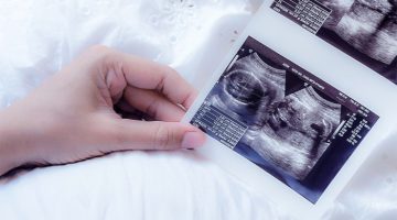 اختصارات السونار للحامل وخطوات تساعدك على التقارير الطبية