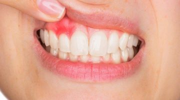 علاج التهاب الاسنان وكيفية التعرف على خطورة الم الاسنان