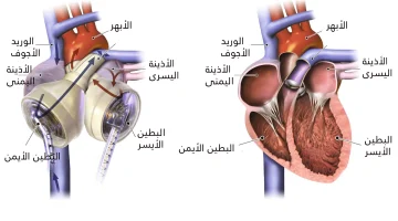 أي جزء من جهاز القلب الصناعي يؤدي الوظيفة الرئيسية للقلب