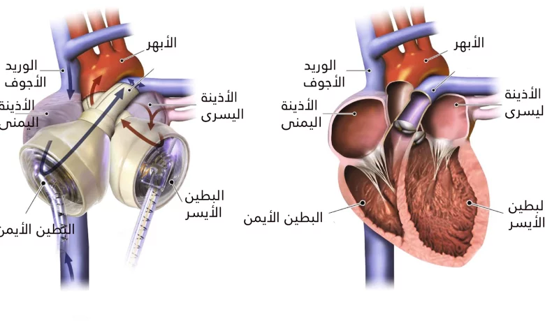 أي جزء من جهاز القلب الصناعي يؤدي الوظيفة الرئيسية للقلب