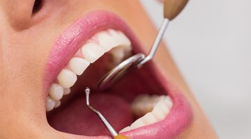 أنواع الم الاسنان وأعراضه والأسباب المؤدية له