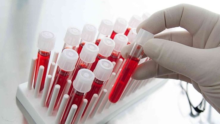 بحث عن فصائل الدم وما هي أنواع فصائل الدم؟